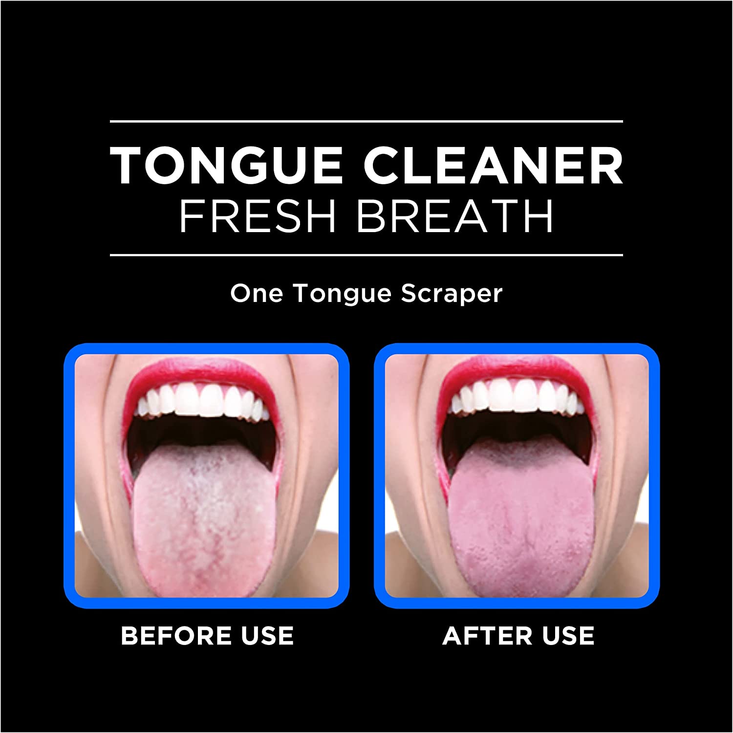 OraBrush™ | Tongue scraper for fresh breath! (1+1 FREE)