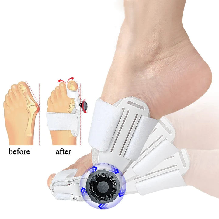 Bunion Correct Pro™ | Orthopaedic Large Toe Corrector!