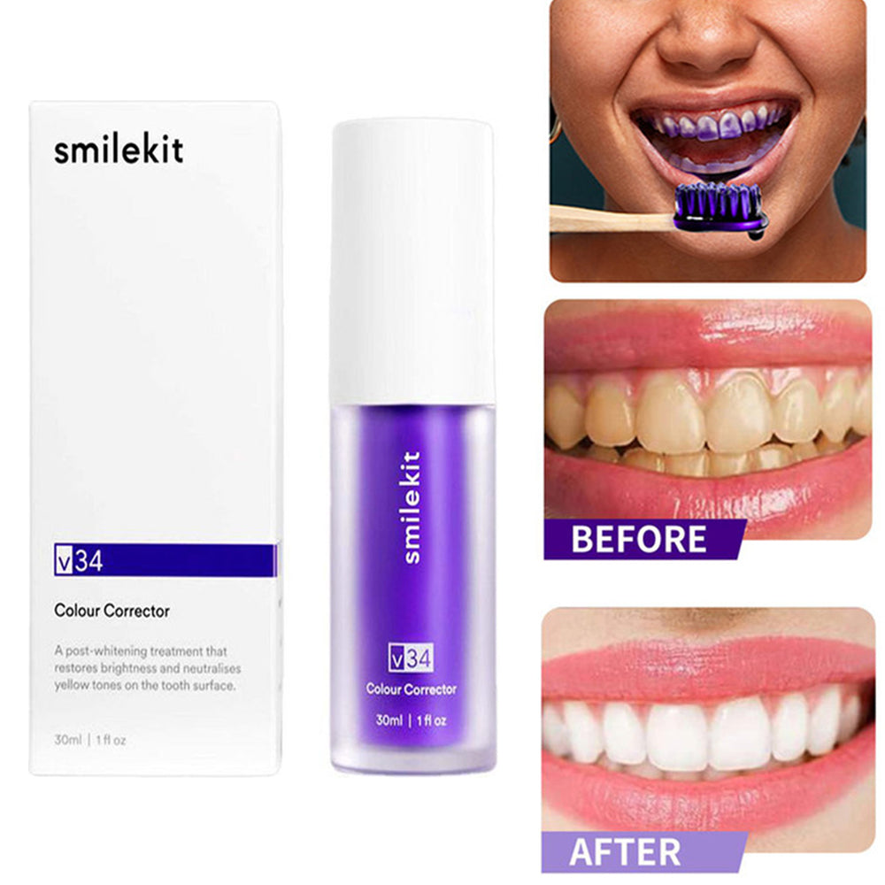 SmileKit™ | V34 diamond colour correction! - UpLivings