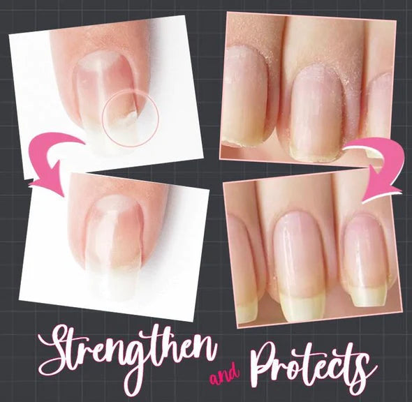 NailProtect™ | Repairs your nail immediately!
