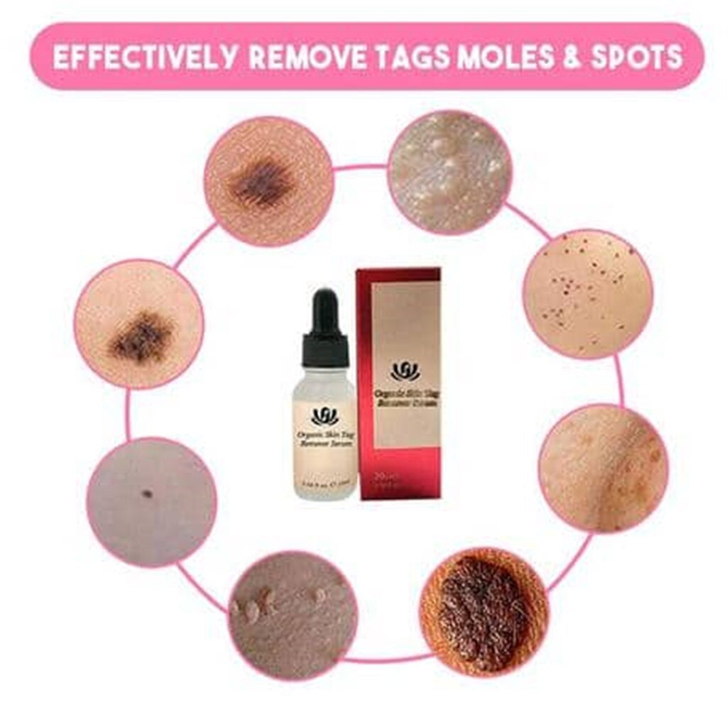 TagSolution™ | Organic Skin Tags Remove Serum - UpLivings