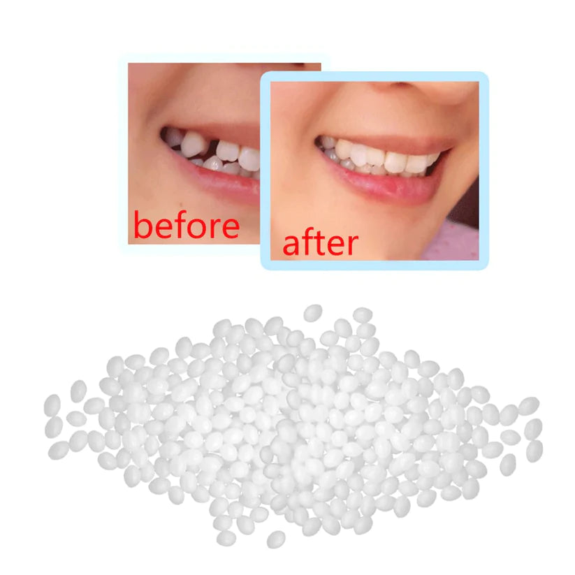 TeethRepair™ | Hide your broken tooth! - UpLivings