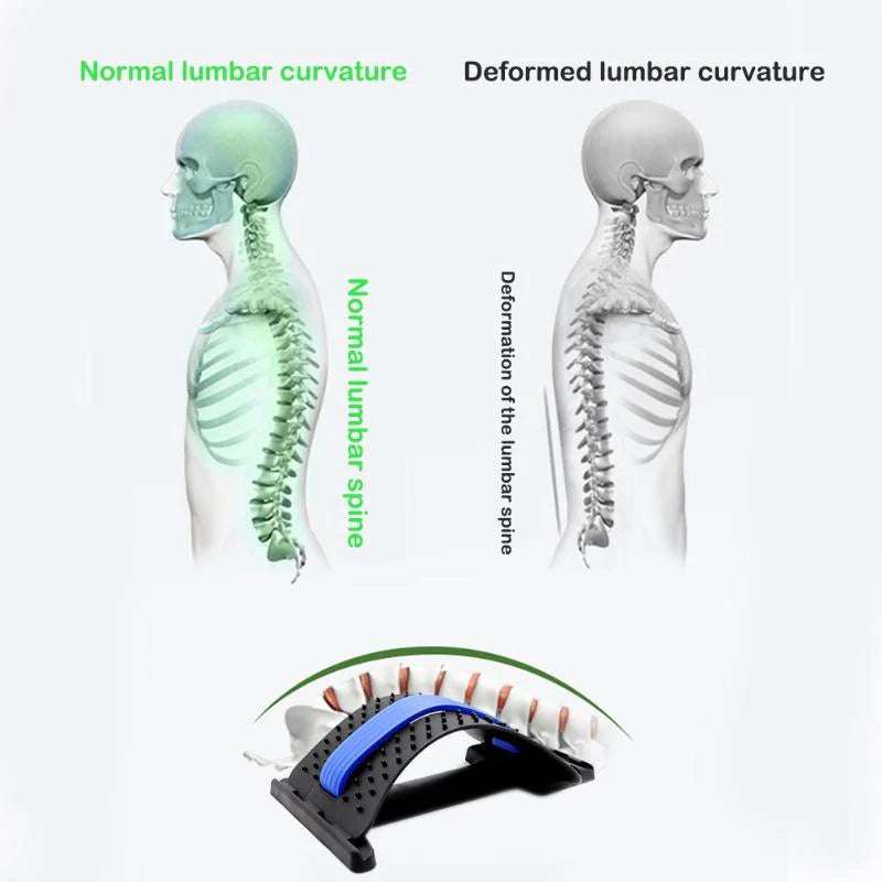 SpineStretcher™ | Recover your back posture!